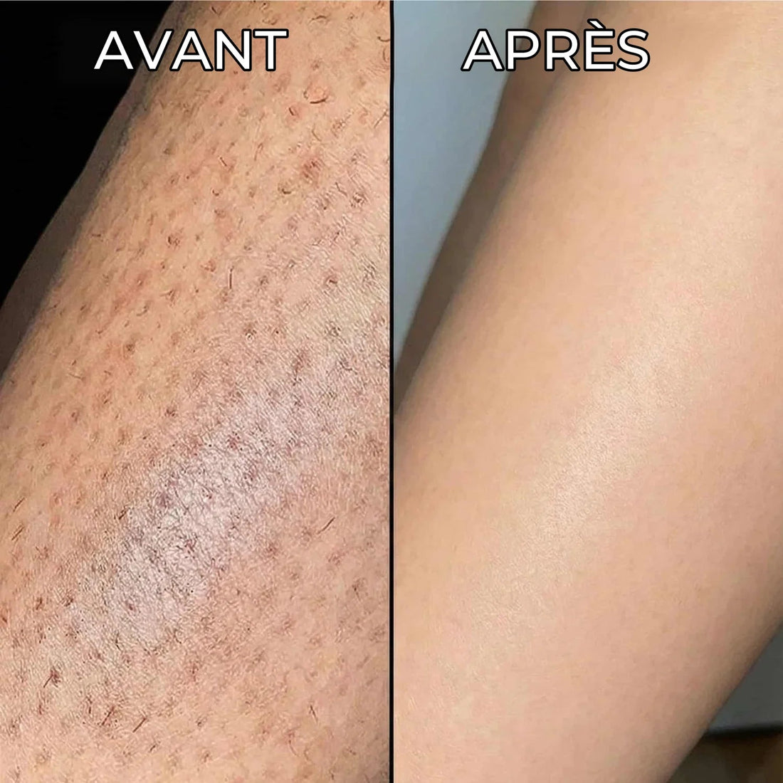 Stop-repousse végétal Nosenia