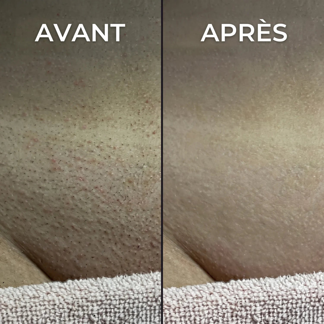 Stop-repousse végétal Nosenia
