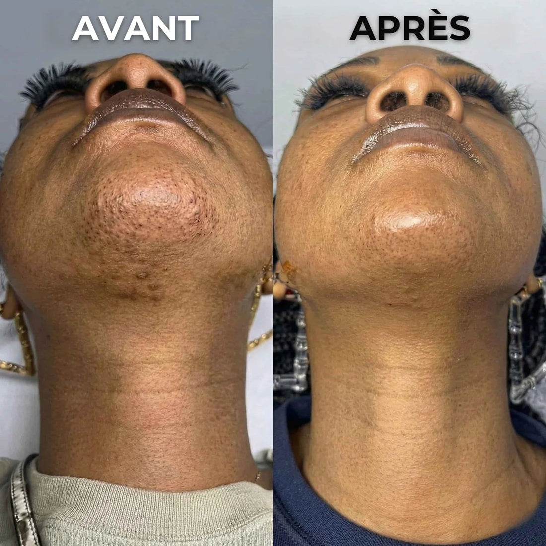 Stop-repousse végétal Nosenia