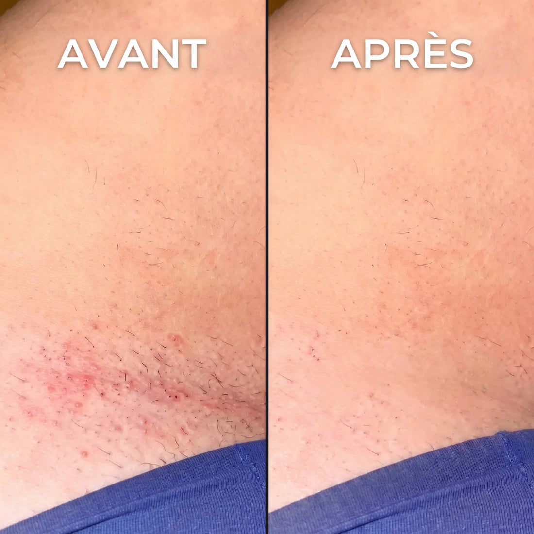 Stop-repousse végétal Nosenia