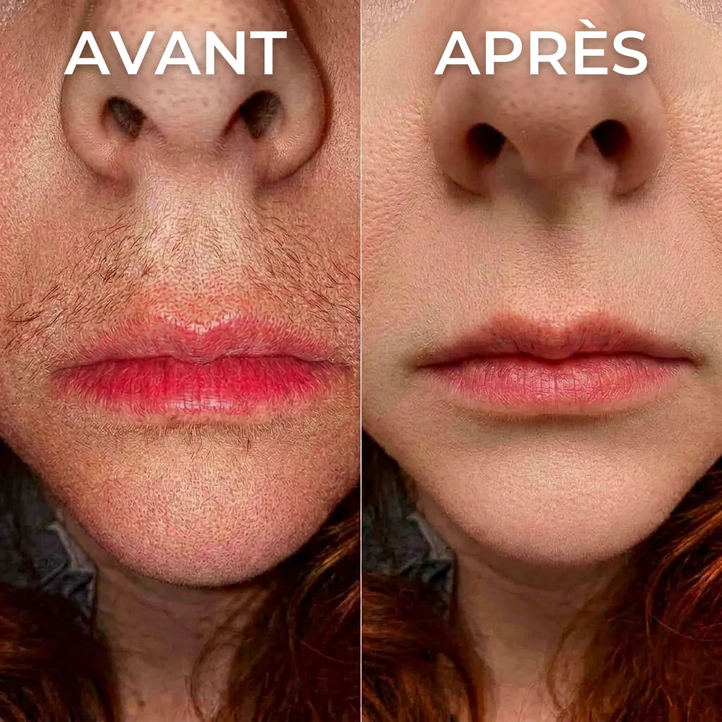 Stop-repousse végétal Nosenia